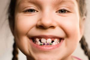 girl smiling with braces