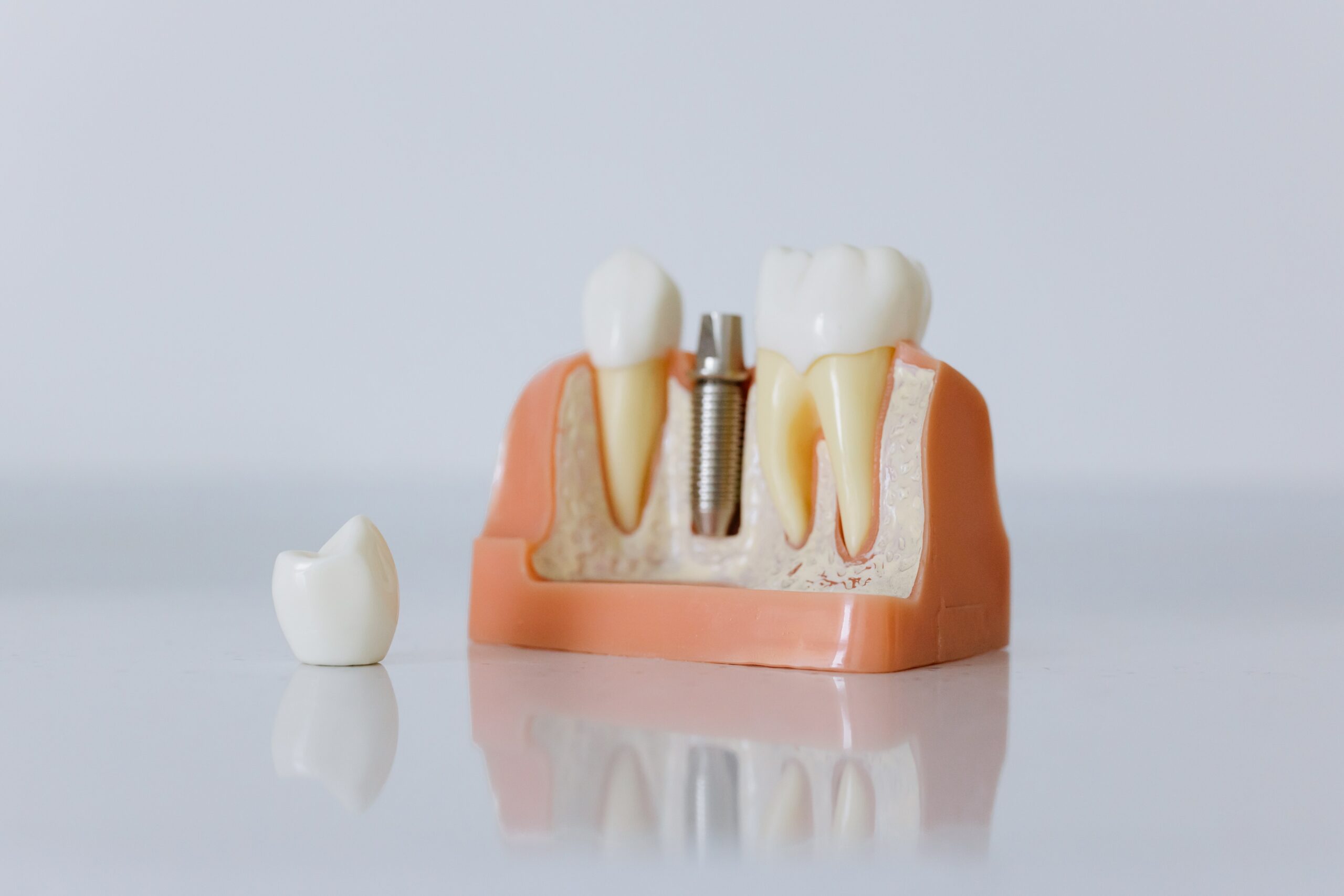 What Are Considered Dental Prosthetics? | Claremont Dental Arts