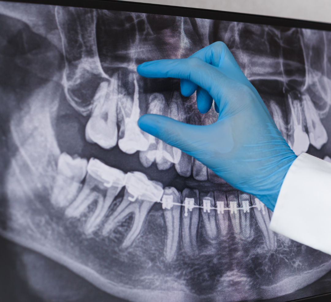 3D Imaging, Digital X-rays, and Other Advanced Dental Technology |  Claremont Dental Arts, image size:1080x985