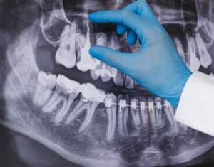 3D Imaging Digital X-rays and Other Advanced Dental Technology