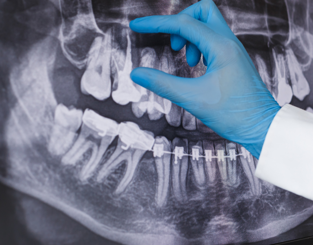 3D Imaging, Digital X-rays, and Other Advanced Dental Technology